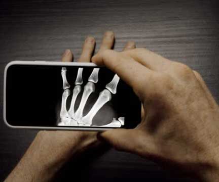 Aplicación que Imita la Funcionalidad de Rayos X en Tu Smartphone