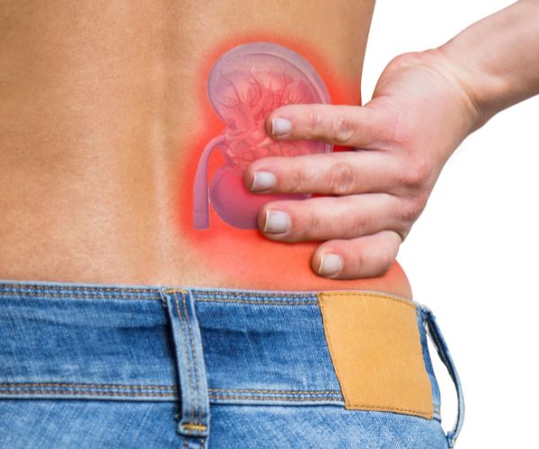 Los Efectos de la Diabetes en los Riñones: Lo que Necesitas Saber